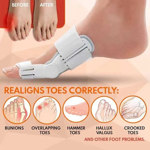ToeEase Bunion Support Splint